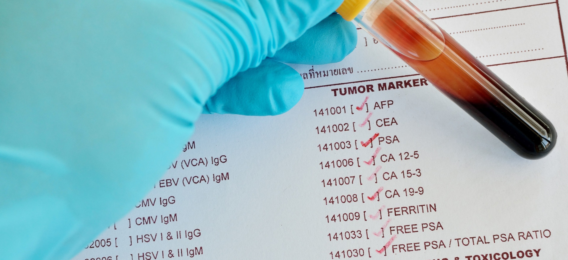 2024-12-09-53-analysis-for-tumor-markersАнализ на онкомаркеры_1920x880_9d2