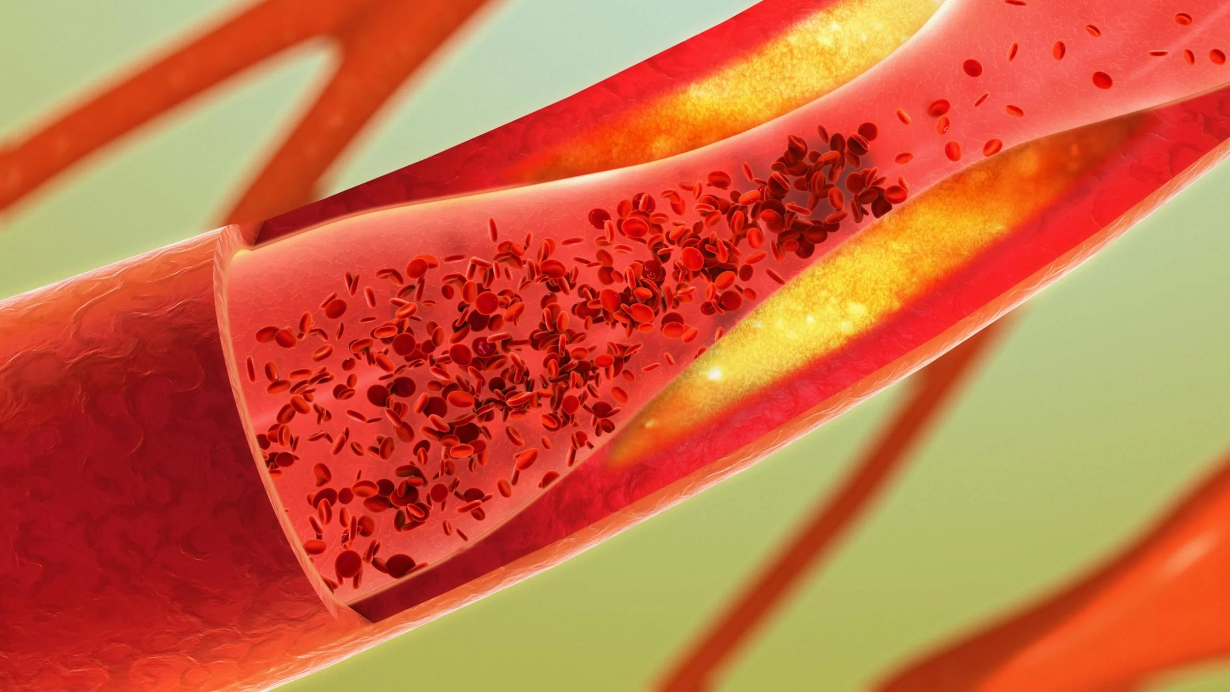 csm_Hemostasis_HORIBA_Medical_56e05270c8