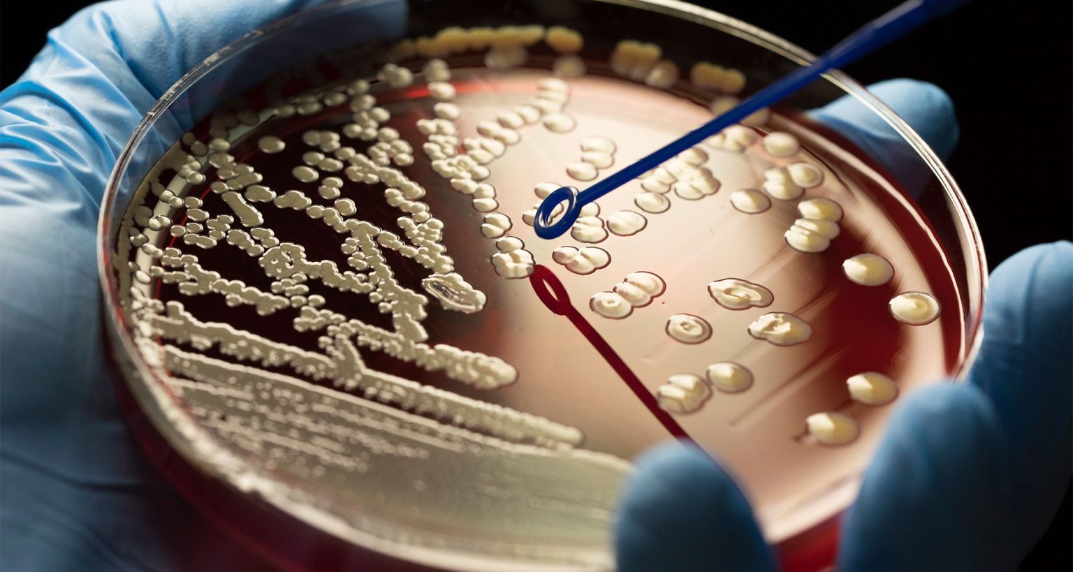 microbiology-diagnostics-pic--1536x819